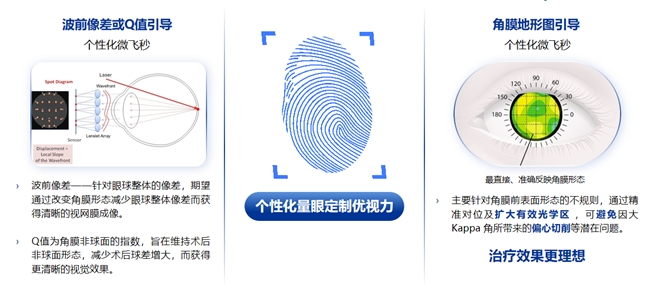 鄭州普瑞丨量眼定制獨一無二的清晰，個性化近視手術，為您提供極致的視覺體驗！(圖2)