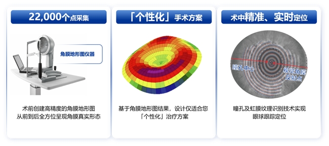 鄭州普瑞丨量眼定制獨一無二的清晰，個性化近視手術，為您提供極致的視覺體驗！(圖3)