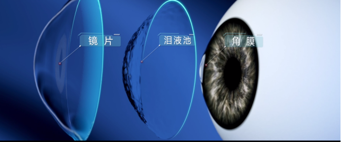 
			林江院長赴長沙見證愛爾眼科鞏膜鏡技術診療門診啟動儀式
		(圖2)