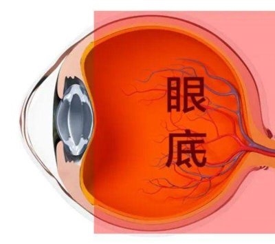 愛爾眼科：激光“打”在眼內(nèi)還能治眼病？
