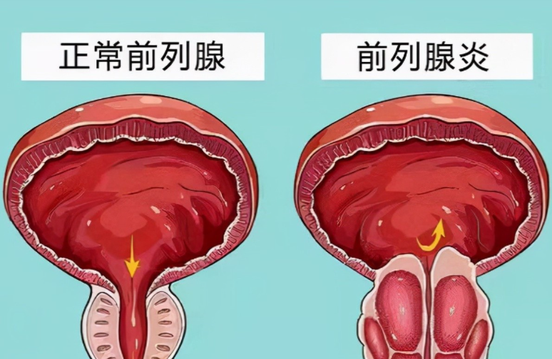 贛州現代泌尿專科醫院好不好？專業醫療，呵護您的健康